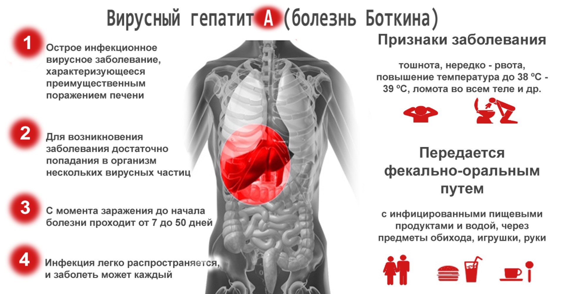 Гепатит А (болезнь грязных рук)